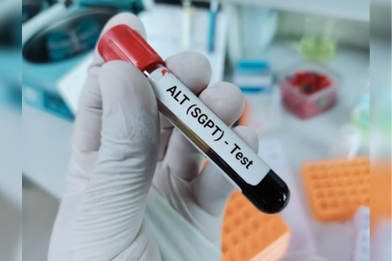 A test tube containing a blood sample for SGPT test