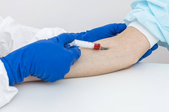 Side view of a gloved hand drawing blood using a syringe from a vein in another hand.